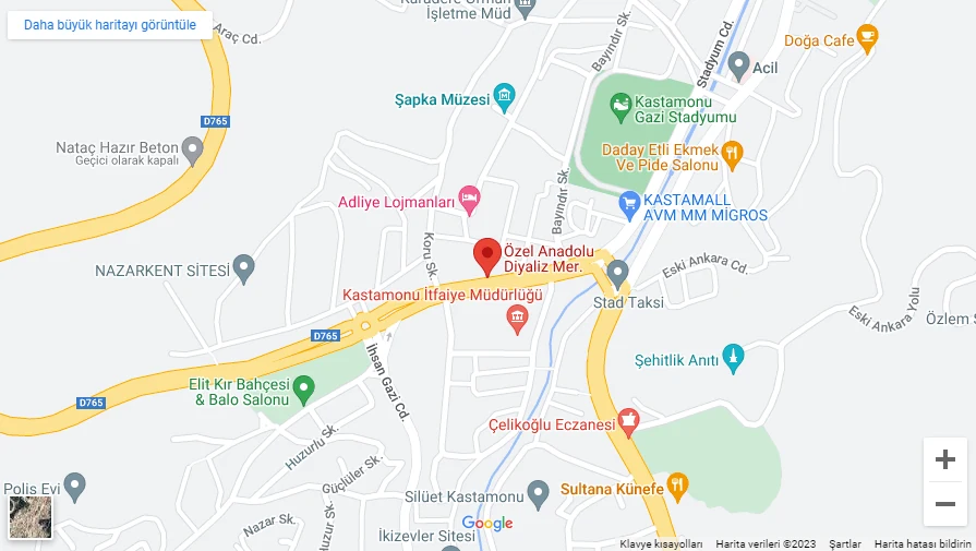 Diyaliz merkezinin Kastamonu şehir merkezindeki konumu